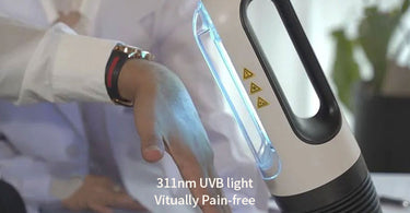 Application of UV phototherapy in the treatment of psoriasis
