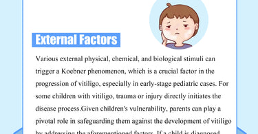 The Rising Incidence of Vitiligo in Young Children: Uncovering the Key Culprits!